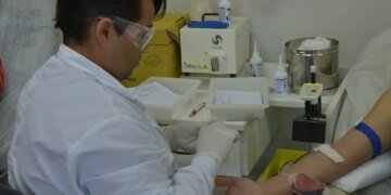 Doença Falciforme: Sintomas Abrangentes, Diagnóstico Precoce e Desafios no Tratamento