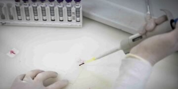 Exames Descartam Ebola em Imigrante Congolês Internado em São Paulo Exames Descartam Ebola em Imigrante Congolês Internado em São Paulo
