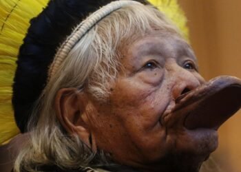 Cacique Raoni Retorna à UTI para Monitoramento Intensivo Após Hemorragia Digestiva