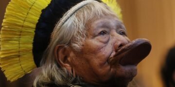 Cacique Raoni Retorna à UTI para Monitoramento Intensivo Após Hemorragia Digestiva Cacique Raoni Retorna à UTI para Monitoramento Intensivo Após Hemorragia Digestiva