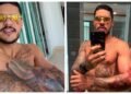 Cantor Hungria sofre acidente de moto e mostra ferimentos