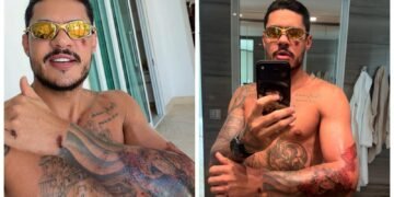 Cantor Hungria sofre acidente de moto e mostra ferimentos