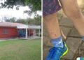 Síndrome mão-pé-boca: creche do interior de SP suspende aulas após 16 crianças serem infectadas; veja sintomas