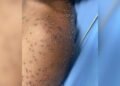 Homem leva centenas de picadas de abelha e é socorrido inconsciente pelos bombeiros, em Itapuranga
