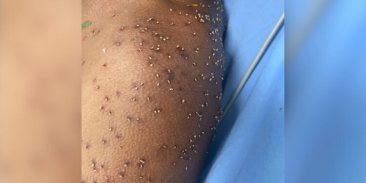 Homem leva centenas de picadas de abelha e é socorrido inconsciente pelos bombeiros, em Itapuranga