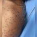 Homem leva centenas de picadas de abelha e é socorrido inconsciente pelos bombeiros, em Itapuranga Homem leva centenas de picadas de abelha e é socorrido inconsciente pelos bombeiros, em Itapuranga