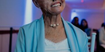 Mulher com síndrome genética rara já teve 73 cânceres de pele e espera cirurgia para reconstruir o nariz